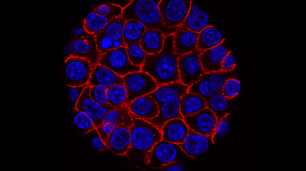 *ONLINE* Thinking On Sunday: Rebel Cell – A New View of Cancer